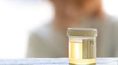 Drug Testing