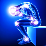 Cannabis as a Treatment for Lupus